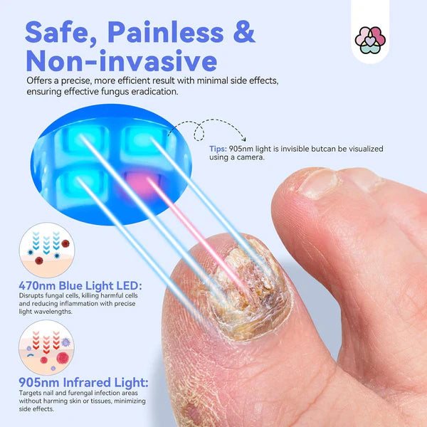 Nail Fungus Rechargeable Cleaning Laser Device