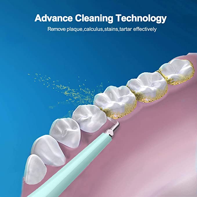 Electric USB Dental Calculus Plaque Remover™